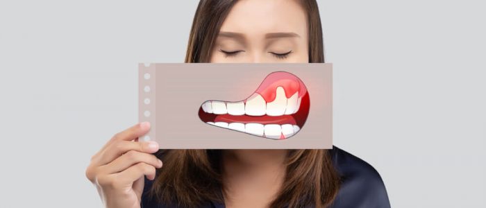 woman holding up a smiling image of teeth and gums