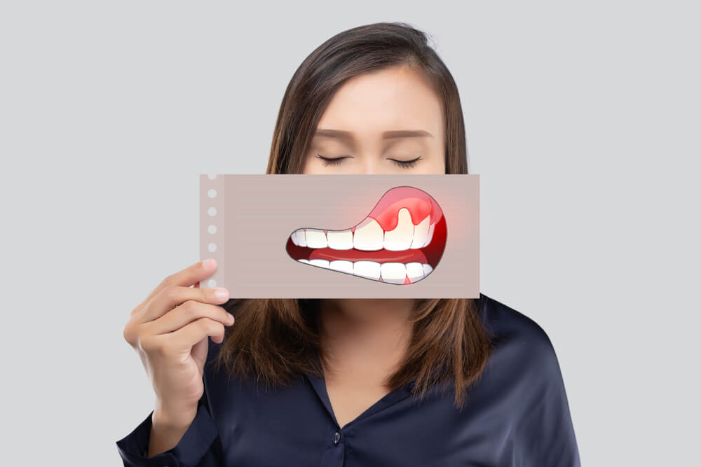 woman holding up a smiling image of teeth and gums