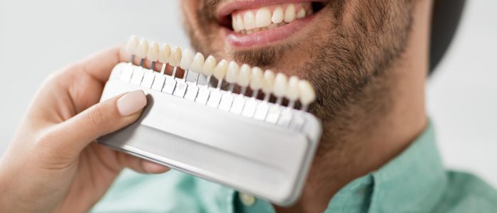 Dentist works with a patient to adjust dental veneers.